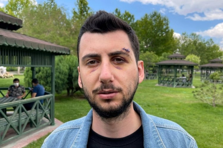 Kız arkadaşını korumak isterken muştayla d&ouml;v&uuml;ld&uuml;