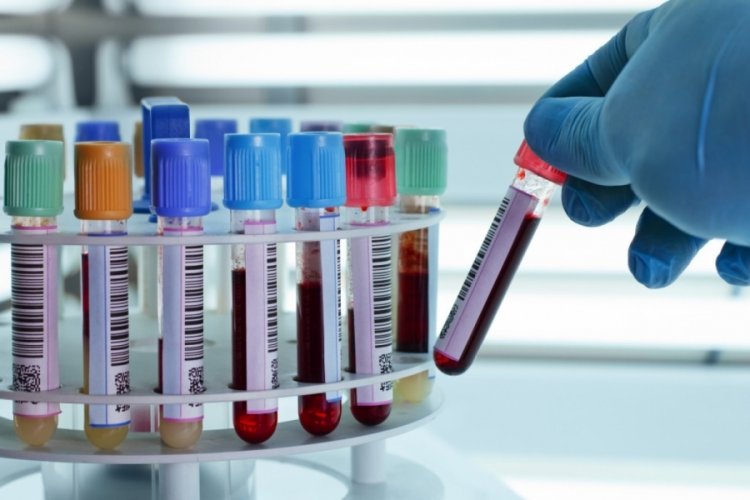 50 kanser t&uuml;r&uuml;n&uuml; tespit edebilen test geliştirildi
