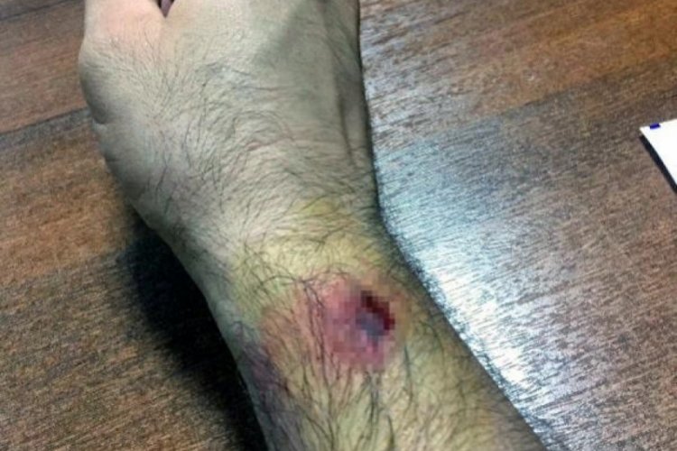 Kumar parasını almak i&ccedil;in polisin elini ısıran ş&uuml;pheli serbest bırakıldı