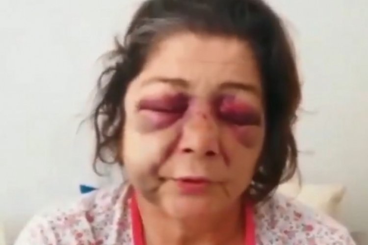 'Park' tartışmasında oğlu ve gelini ile birlikte darbedildi