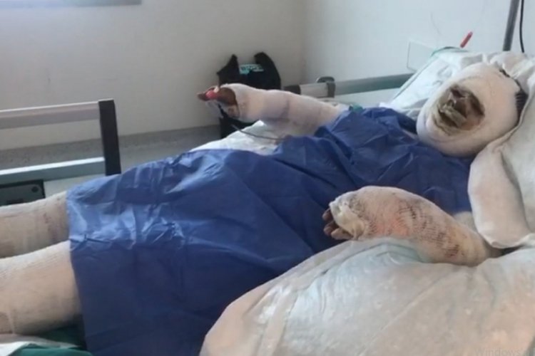 Mersin'de damat dehşeti! Benzin d&ouml;kerek yaktı
