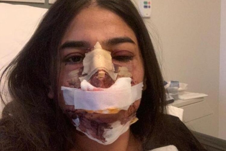 Avusturya'dan İstanbul'a gelen gen&ccedil; kadına estetik şoku!