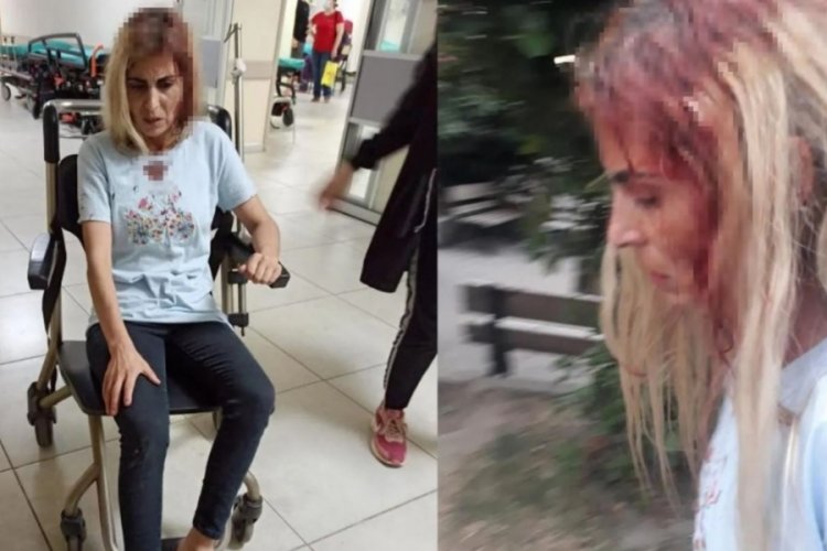 '&Ouml;ld&uuml;r&uuml;lmek istemiyorum' demişti, sopayla d&ouml;v&uuml;ld&uuml;