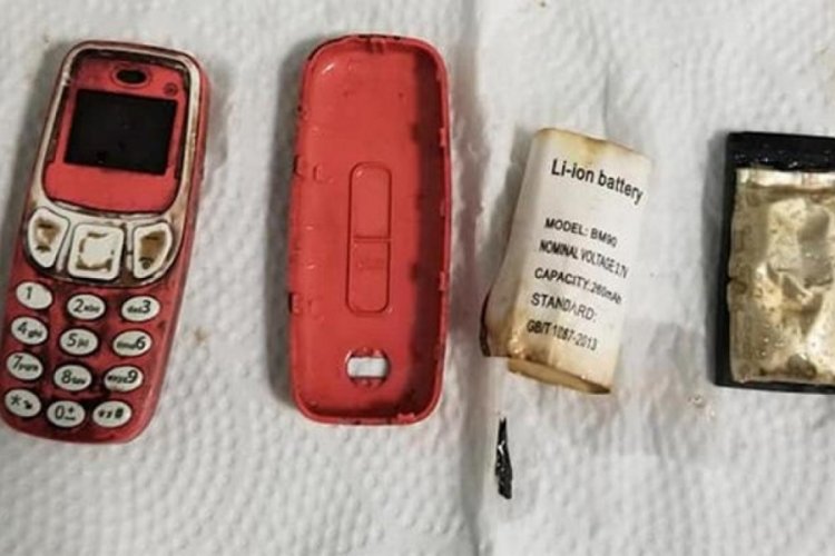 Kosova Priştine'de doktorlar, hastanın midesinden telefon &ccedil;ıkardılar