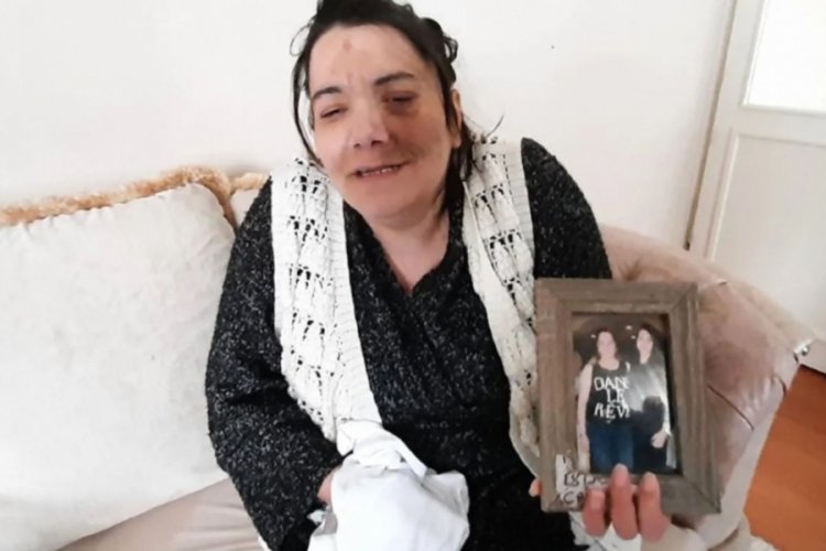 Damak tedavisinin ardından hayatını kaybetti