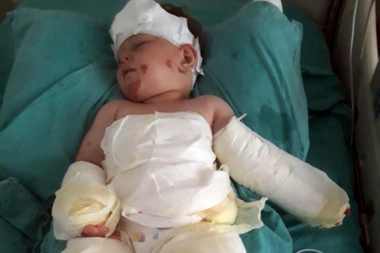 İzmir'de eşi ve oğlunun &uuml;zerine kolonya d&ouml;kerek yaktı