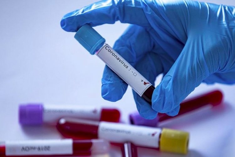 Alman ila&ccedil; şirketinin &uuml;rettiği ilacın test sonu&ccedil;ları &ccedil;ıktı!