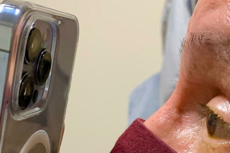 ABD'li g&ouml;z doktoru, tedavi i&ccedil;in iPhone 13 Pro Max kullanıyor