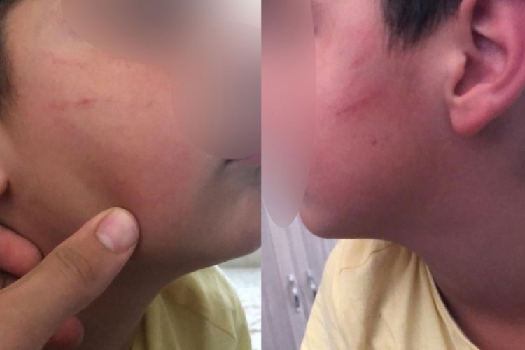 Mersin'in bulunan ilkokulda &ouml;ğretmenden dayak iddiası