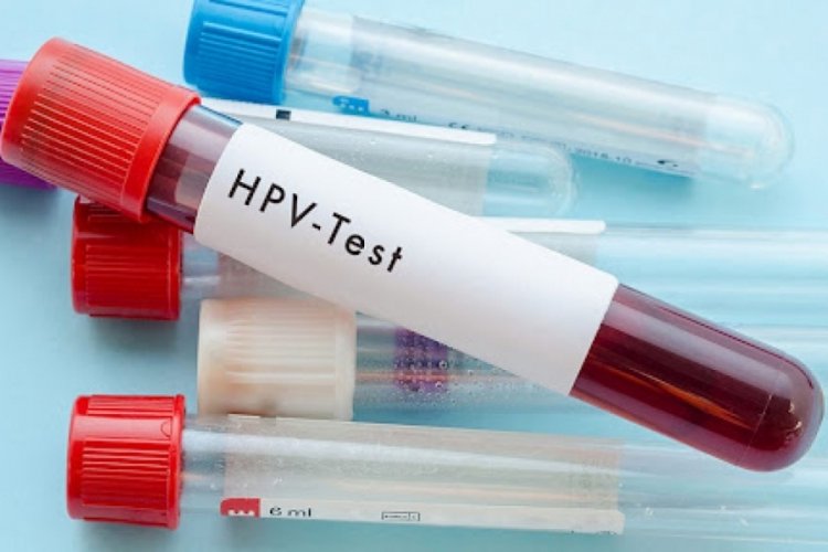 HPV virüsü her geçen gün artıyor! (ÖZEL HABER)