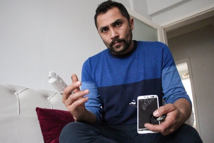 Erzurum'da patlayan powerbank parmağını kopardı