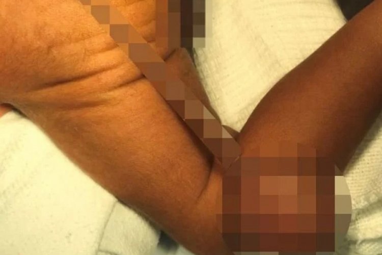 Bilim insanları şaşkın! 12 santim kuyrukla doğdu