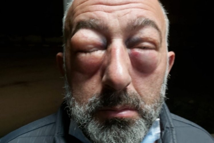 Kocaeli'de otob&uuml;s şof&ouml;rleri yolcuyu d&ouml;vd&uuml;
