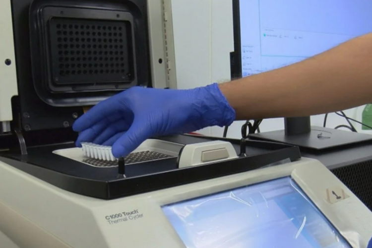 Yerli PCR kiti geliyor! Doğruluk oranı y&uuml;zde 100'e yakın