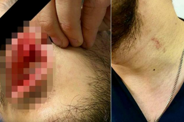 Hastanede dehşet! Sağlık &ccedil;alışanına tekme tokat saldırdı