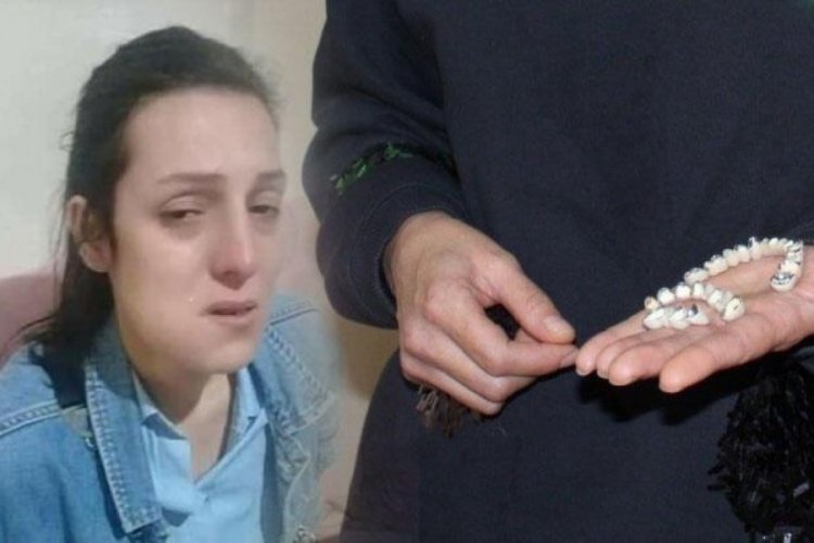Diş tedavisi hayatını cehenneme &ccedil;evirdi!