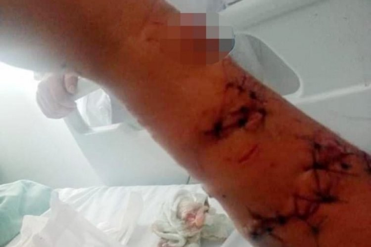 14 yaşındaki &ccedil;ocuk kolunu ısıran k&ouml;pekbalığının burnunu sıkarak saldırıdan kurtuldu