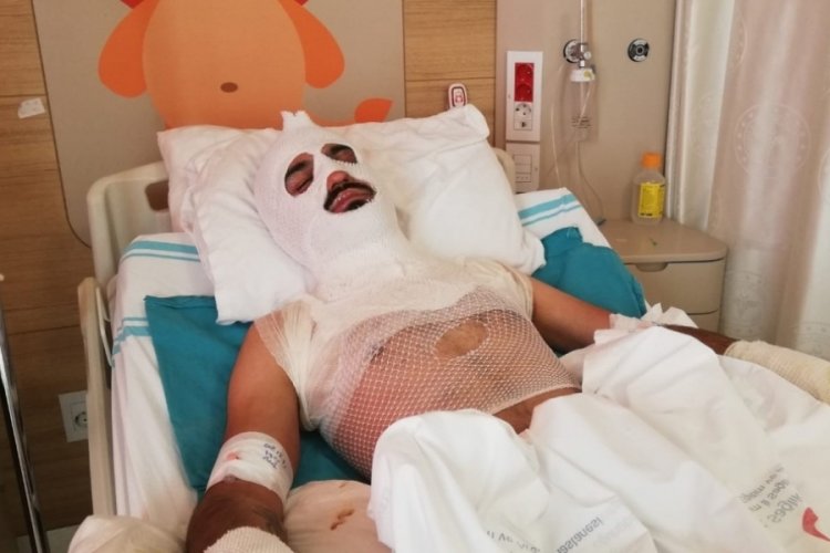 Isınmak i&ccedil;in tenekeye tiner atınca olanlar oldu