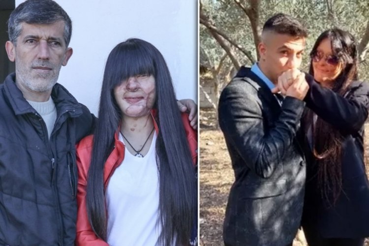 Y&uuml;z&uuml;n&uuml; asitle yakan sevgilisiyle evlenen Berfin'in babası konuştu