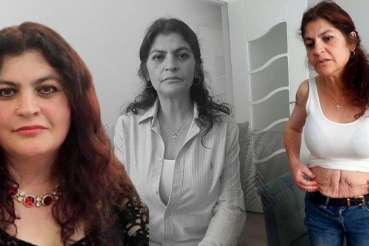 Estetik ameliyat yaptırdığına pişman oldu!