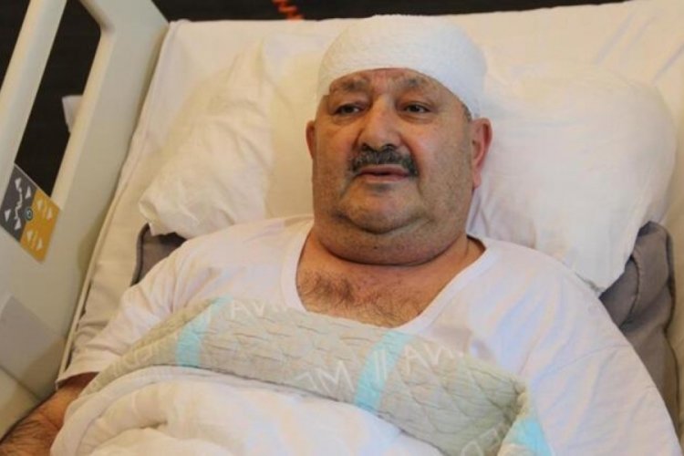 Sağlam olan 6 dişini &ccedil;ektirdi, ger&ccedil;ek bambaşka &ccedil;ıktı!