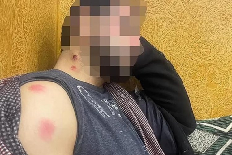 Taliban tarafından kan donduran işkenceyi Afgan terc&uuml;man anlattı