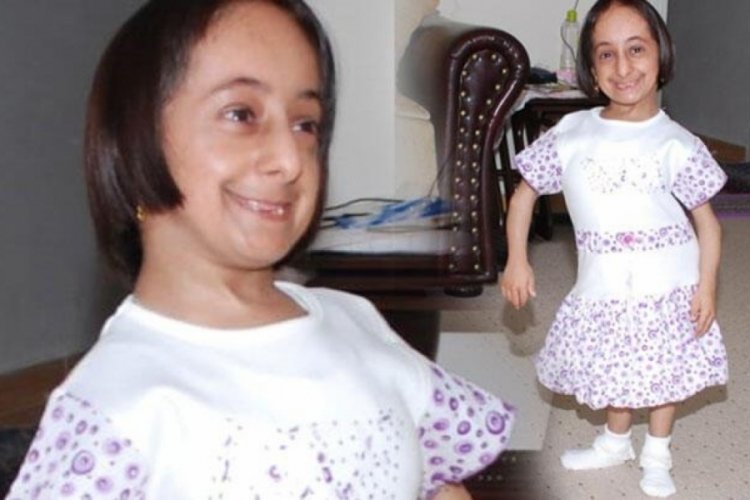 T&uuml;rkiye'nin en kısa boylu kadını yaşamını yitirdi