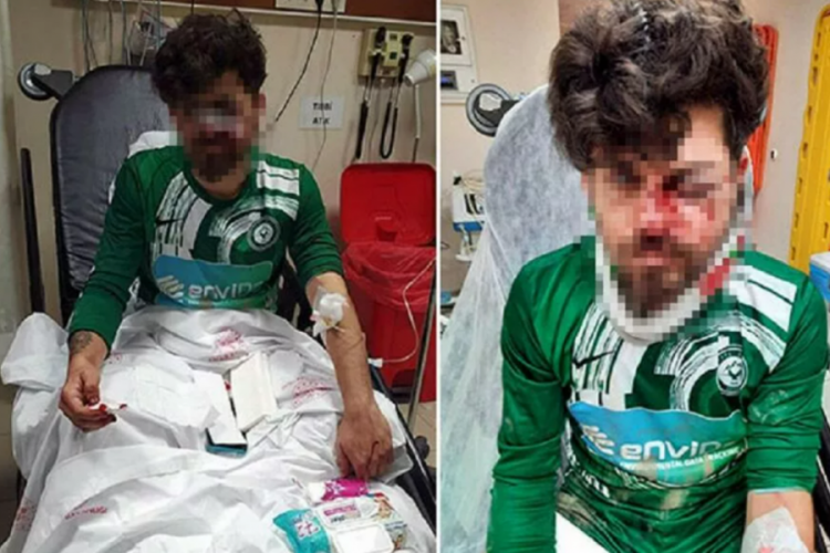 Kırmızı kart g&ouml;ren futbolcu, yerde yatan rakibinin y&uuml;z&uuml;ne tekme attı