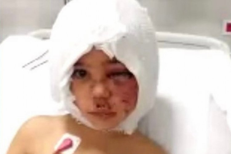 Gaziantep'te pitbull saldırısında yaralanan Asiye, hamburger ve oyuncak istemiş