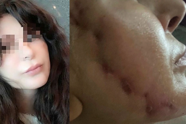 Gen&ccedil; kızın hayatı Fransız askısıyla karardı