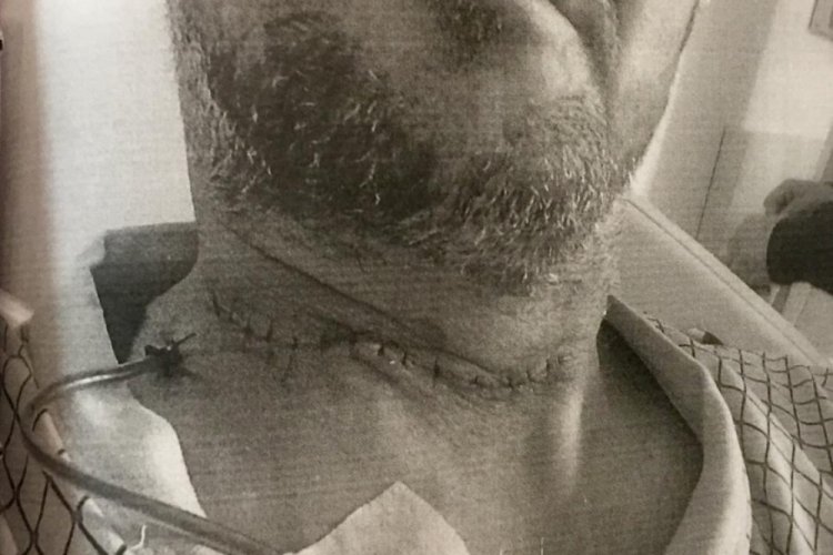 Ankara'da arkadaşının boğazını kesen sanığa hapis istemi