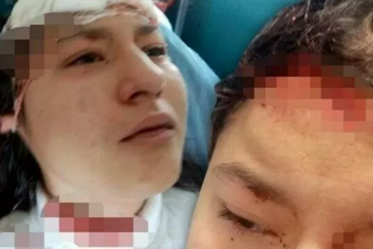 14 yaşındaki &ccedil;ocuğa, selfie &ccedil;ekerken 5 k&ouml;pek saldırdı