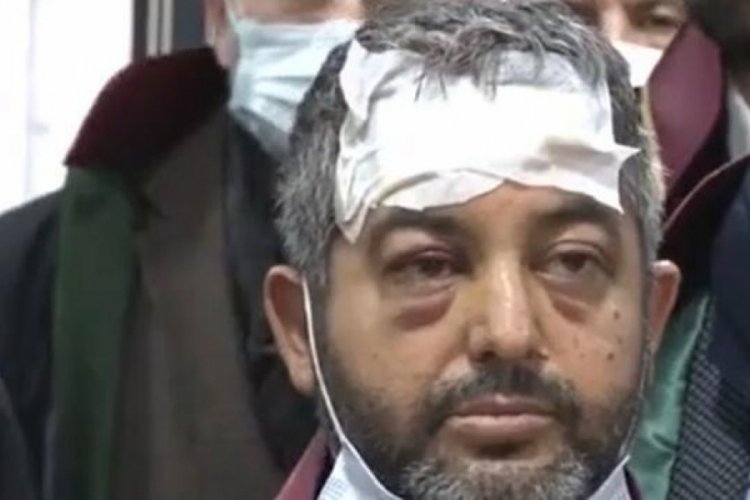 Avukata beyzbol sopalı saldırıda istenen ceza belli oldu