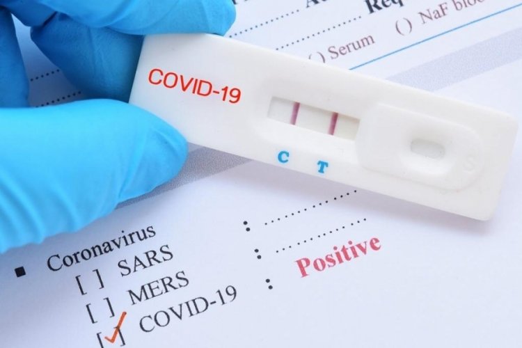 4 dakikada doğru sonu&ccedil; veren test kiti geliştirildi!