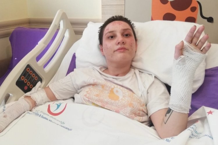 Yangından kurtuldu ama son 2 ayı hatırlamıyor