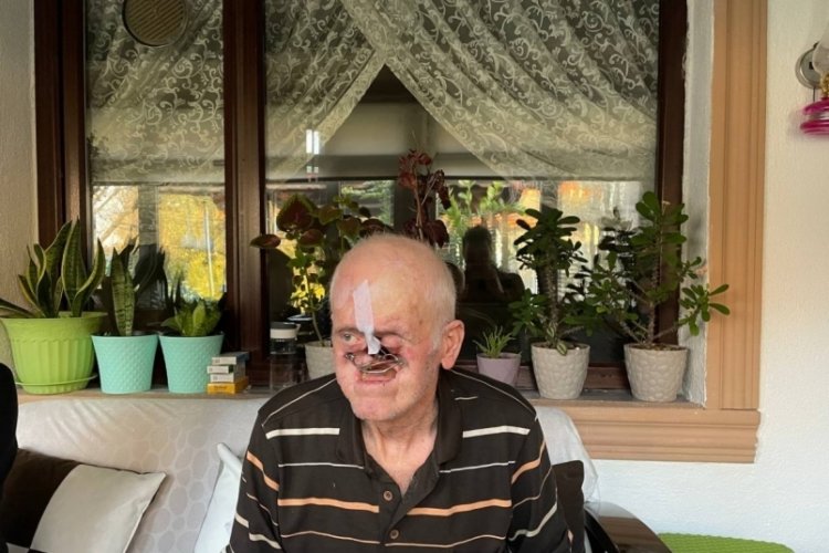 Burnu her g&uuml;n milim milim eridi