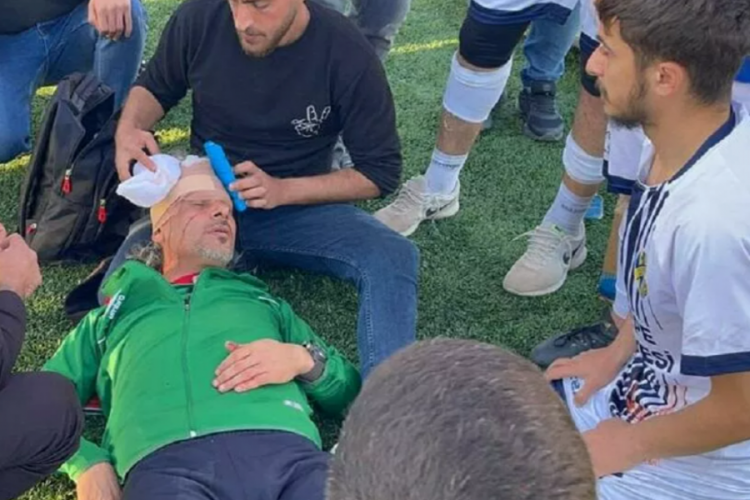 Ma&ccedil; sonrası kavga: 9 futbolcu ile antren&ouml;r yaralandı
