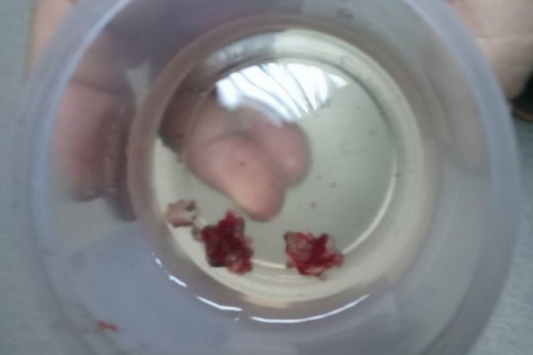 Adana'da ilgin&ccedil; olay! Baş ağrısıyla gittiği hastanede...