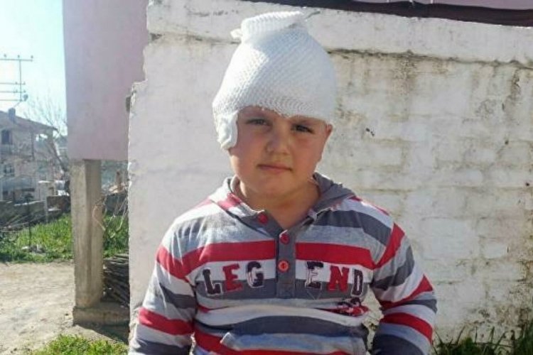 İzmir'de 6 yaşındaki H&uuml;seyin &Ccedil;ınar'a k&ouml;pek saldırdı