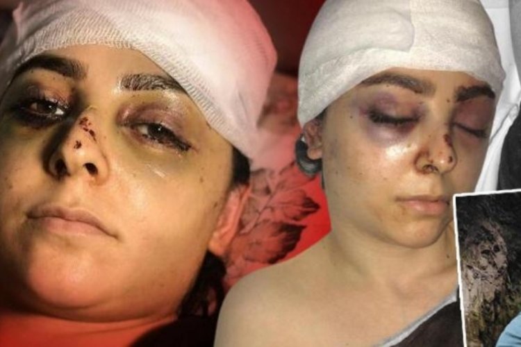İstanbul'da dehşet! Tayt giydiği i&ccedil;in darp etti