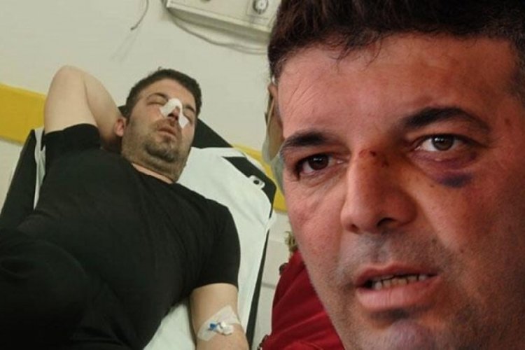 Gaziantep'te m&uuml;sizyen, gittiği d&uuml;ğ&uuml;nde darp edildi