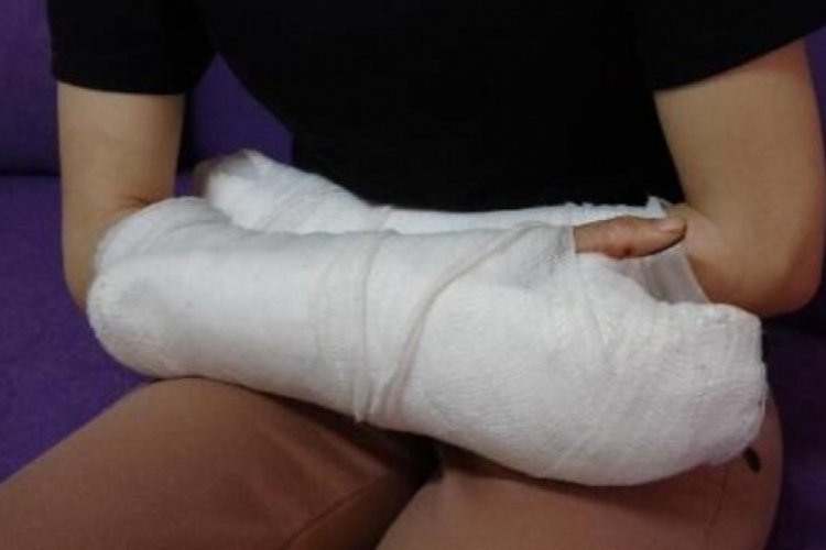 Eşinin 5 parmağı koparttığı İlke: &Ouml;ld&uuml;rmek i&ccedil;in geldiğini biliyordum