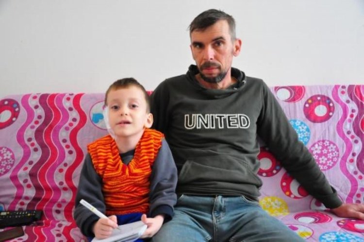6 yaşındaki Kazım'ın derisi, protezi kabul etmedi
