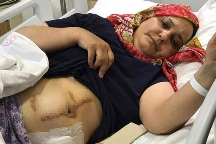 Yoğun bakımdan &ccedil;ıkan kadın, eşinin uyguladığı işkenceleri anlattı