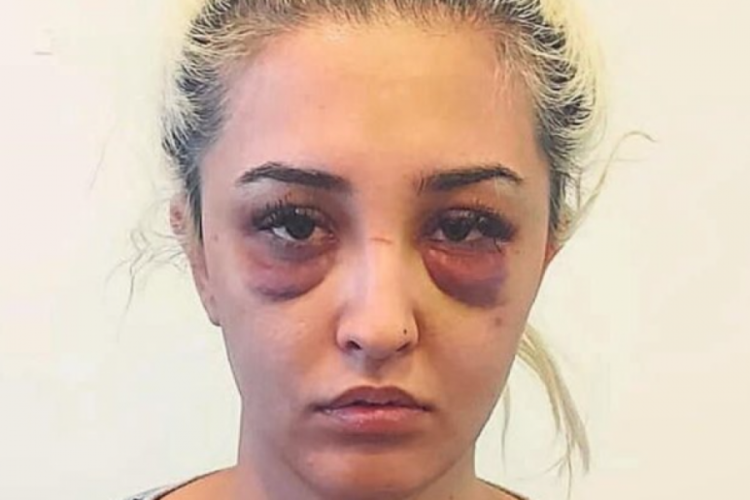 İzmir'de sevgilisi Gamze'yi tanınmaz hale getirdi
