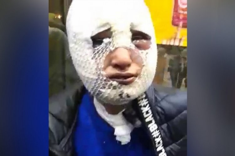 Eski s&ouml;zl&uuml;s&uuml;n&uuml; kızgın yağ ile yakan saldırgana tahliye