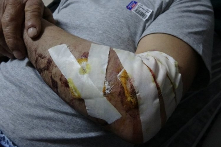Bing&ouml;l'de yaşlı adam k&ouml;peğin saldırısına uğradı