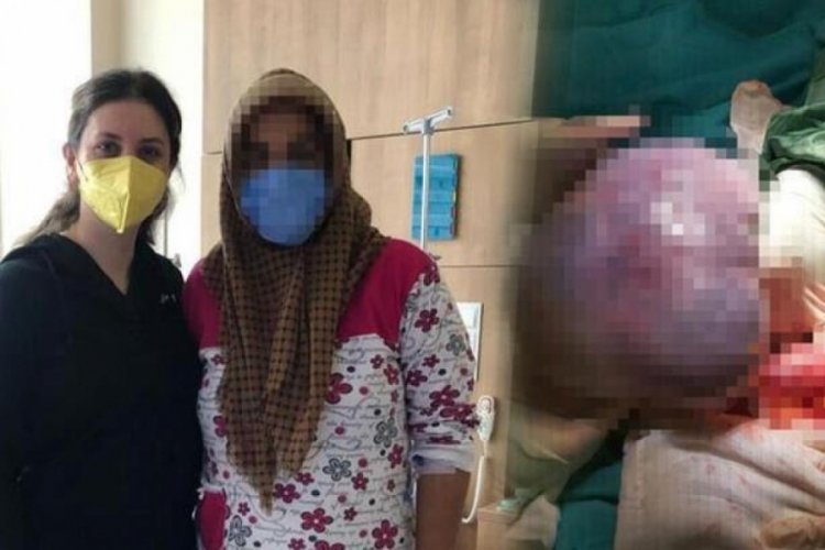 Kastamonu'da hastaneye gitti, 3 kilo kist &ccedil;ıktı
