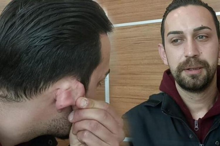 İstediği sigarayı alamayınca gencin kulağını kesti!