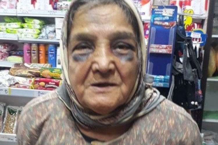 Eşini d&ouml;vd&uuml;ğ&uuml; iddiasıyla yargılanıyordu, para cezası verildi